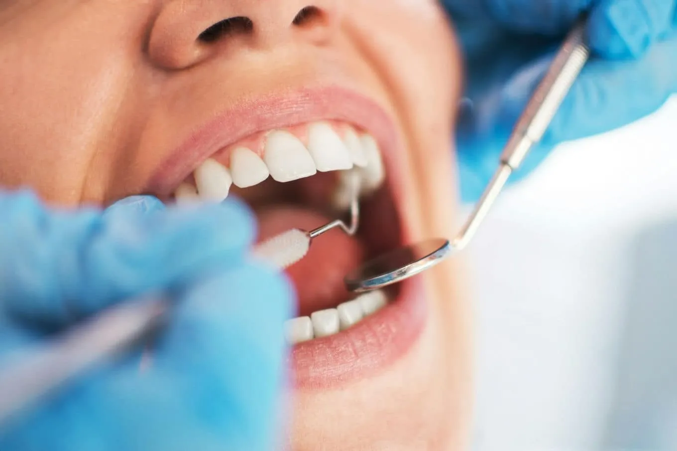 Badanie dziąseł u dentysty