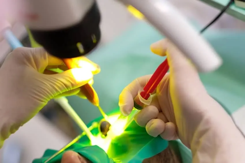 Leczenie pod mikroskopem. Endodoncja mikroskopowa..