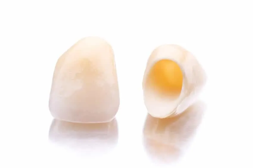 Korona porcelanowa. Korona pełnoceramiczna.