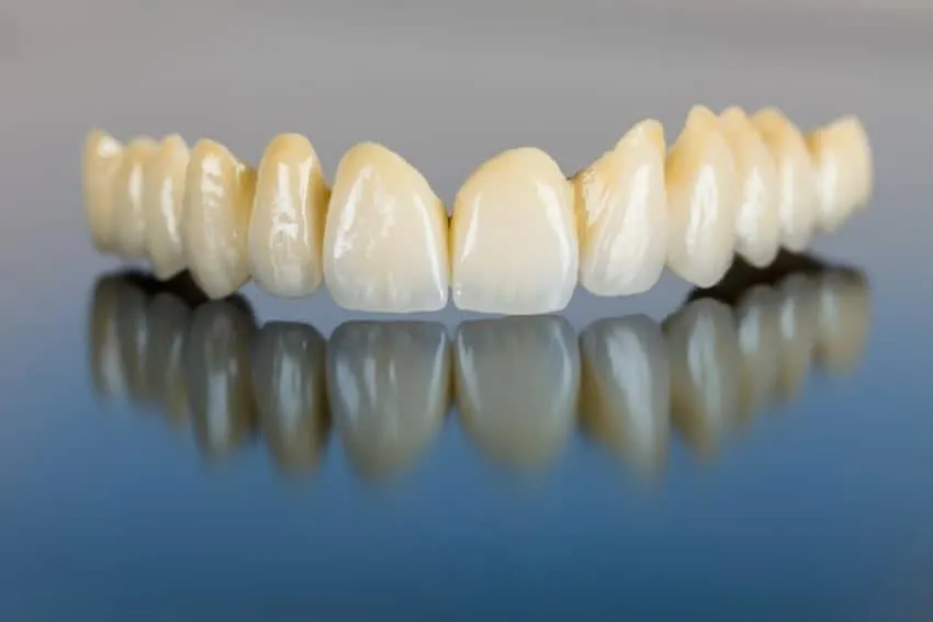Korony ceramiczne na zęby przednie